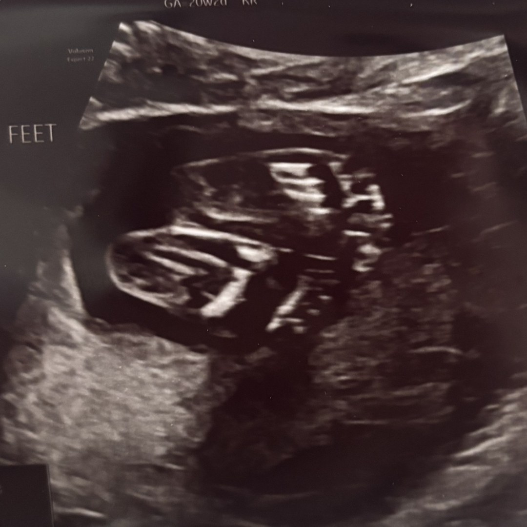 Photo shared by Aisha for their Babylist baby registry.