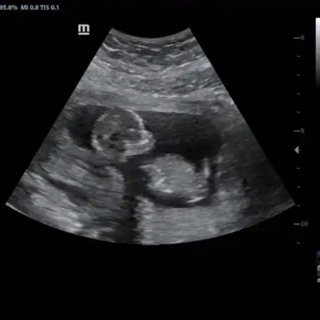 Photo shared by Crystal for their Babylist baby registry.