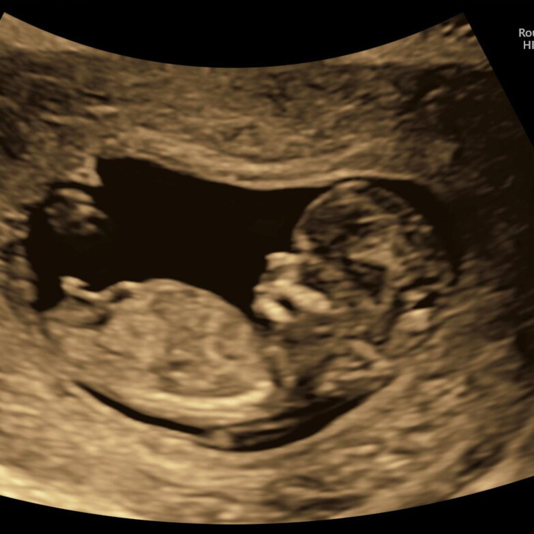 Photo shared by Lily for their Babylist baby registry.