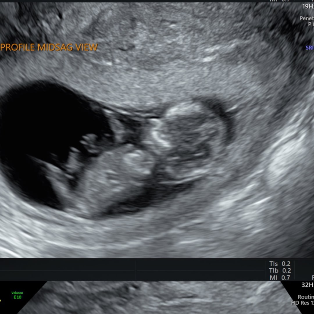 Photo shared by Alyssa for their Babylist baby registry.