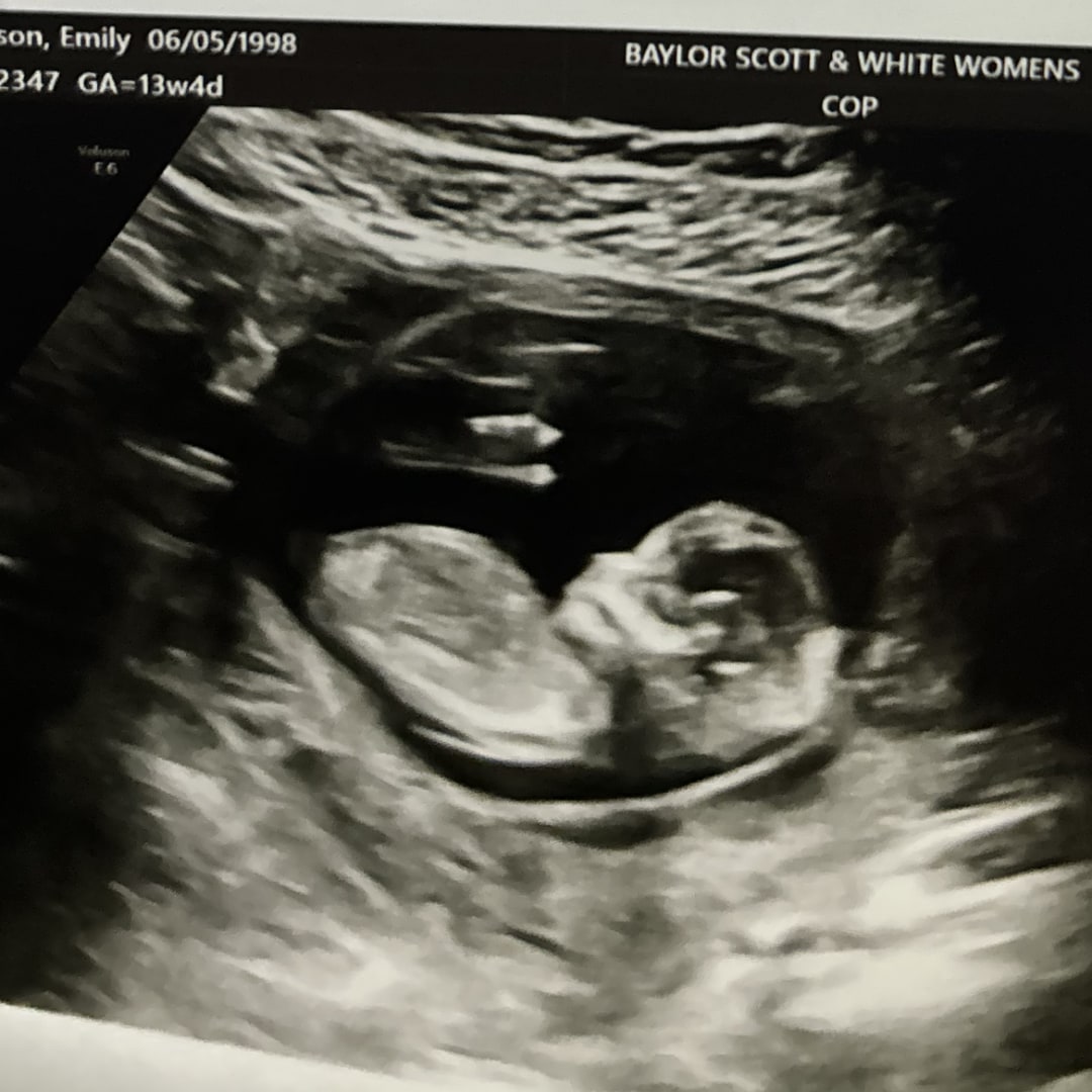 Photo shared by Emily for their Babylist baby registry.