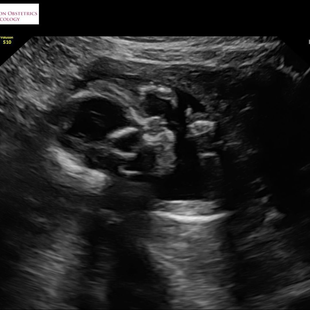 Photo shared by Jessica for their Babylist baby registry.