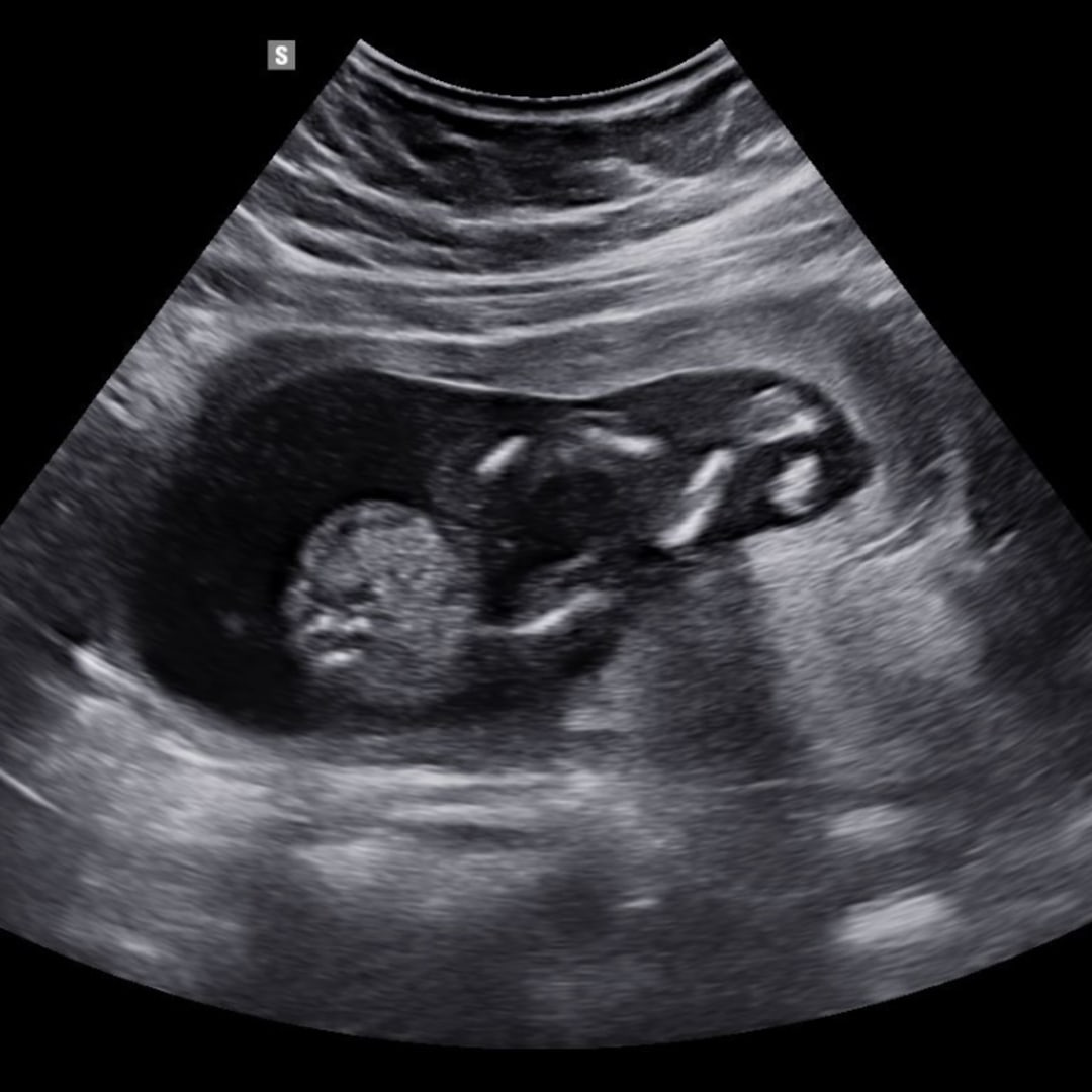 Photo shared by Cheyenne for their Babylist baby registry.
