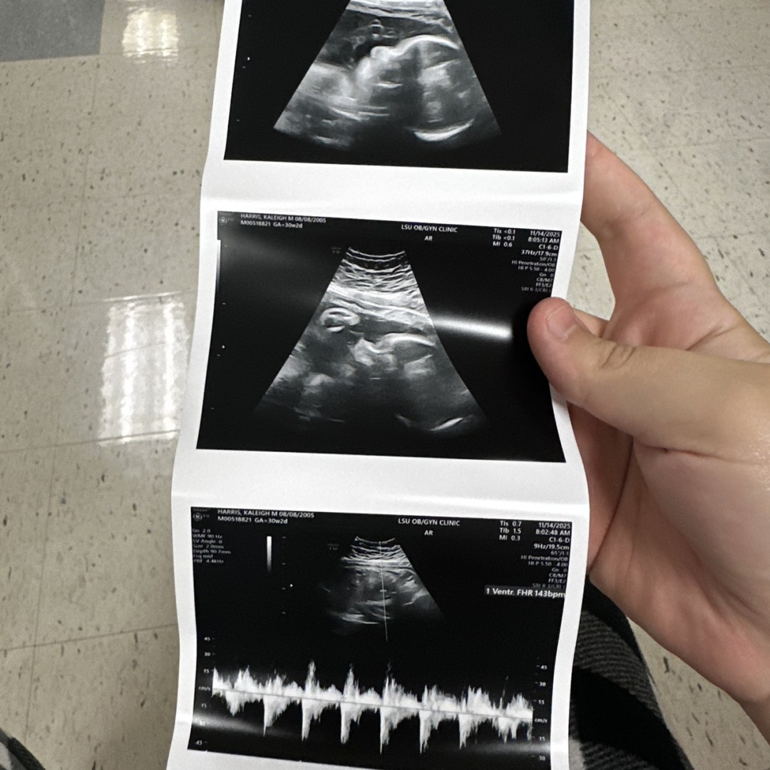 Photo shared by Kaleigh for their Babylist baby registry.