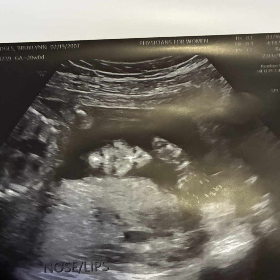 Photo shared by Bruklynn for their Babylist baby registry.