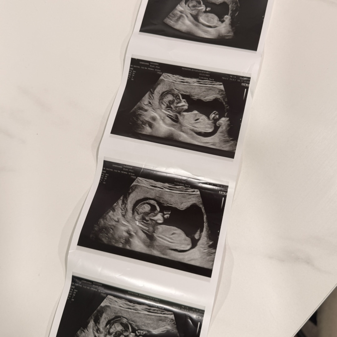 Photo shared by Aliya for their Babylist baby registry.
