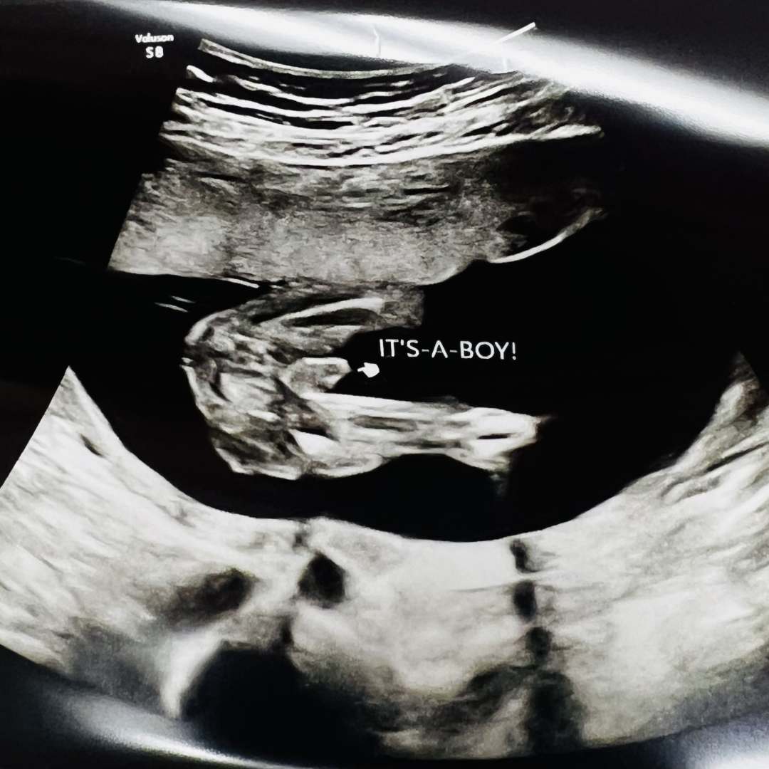 Photo shared by Sary for their Babylist baby registry.