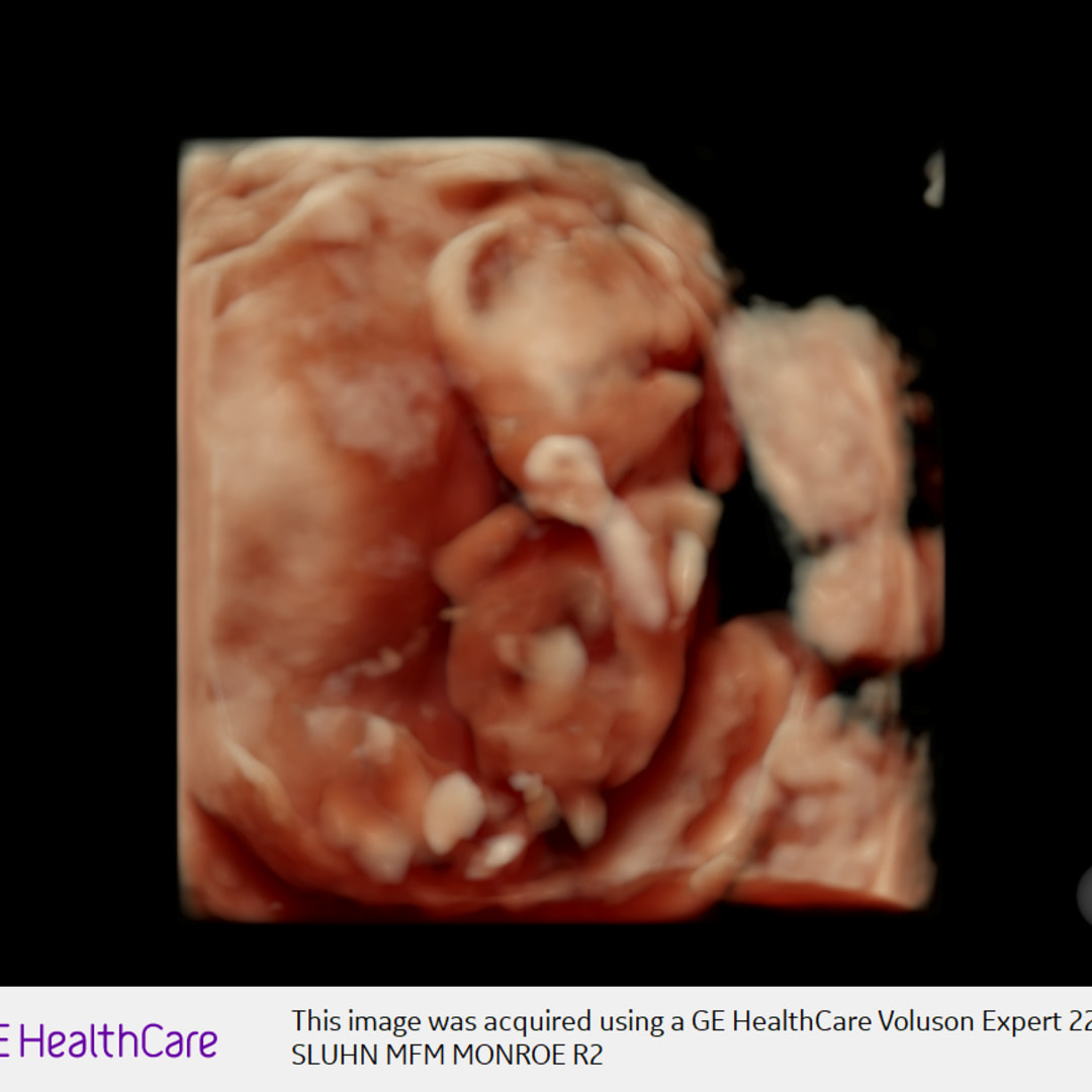 Photo shared by Brandy for their Babylist baby registry.