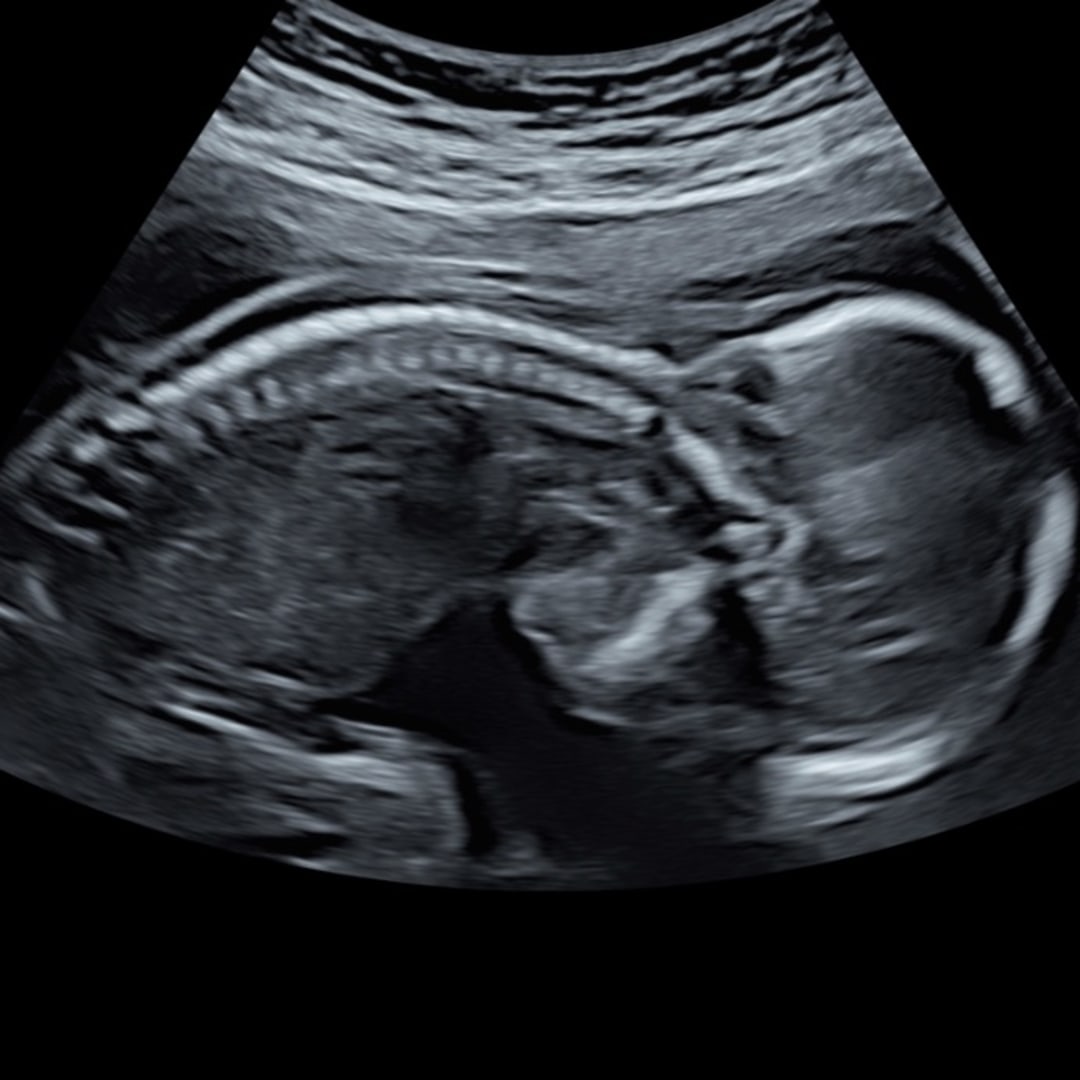 Photo shared by Brielle for their Babylist baby registry.
