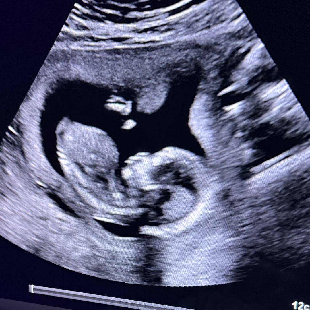 Photo shared by Hannah for their Babylist baby registry.