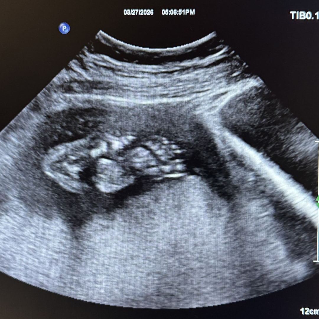 Photo shared by Hallie for their Babylist baby registry.