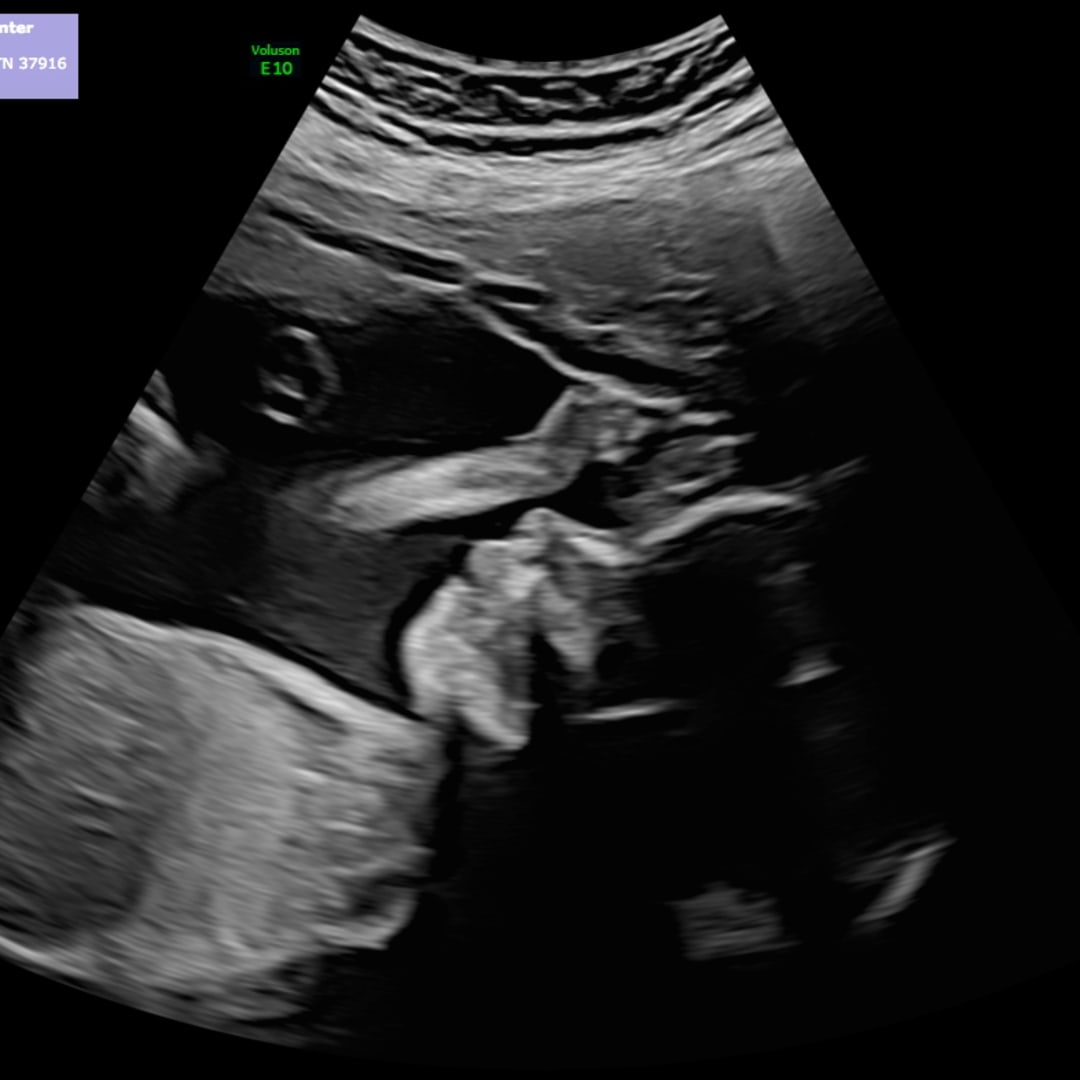 Photo shared by Savonnah for their Babylist baby registry.