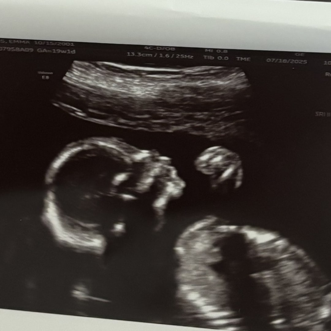 Photo shared by Emma for their Babylist baby registry.