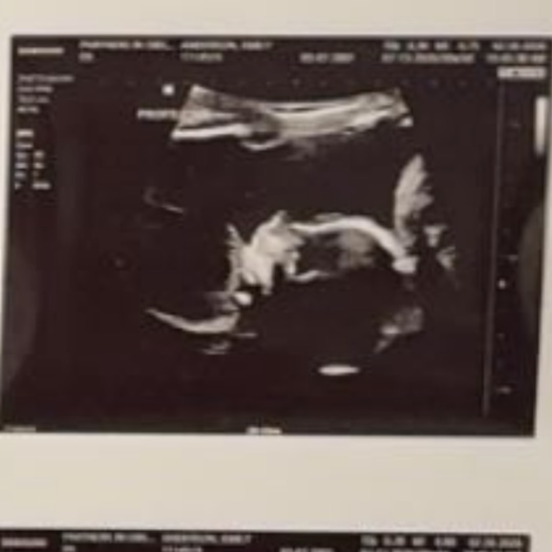 Photo shared by Emily for their Babylist baby registry.