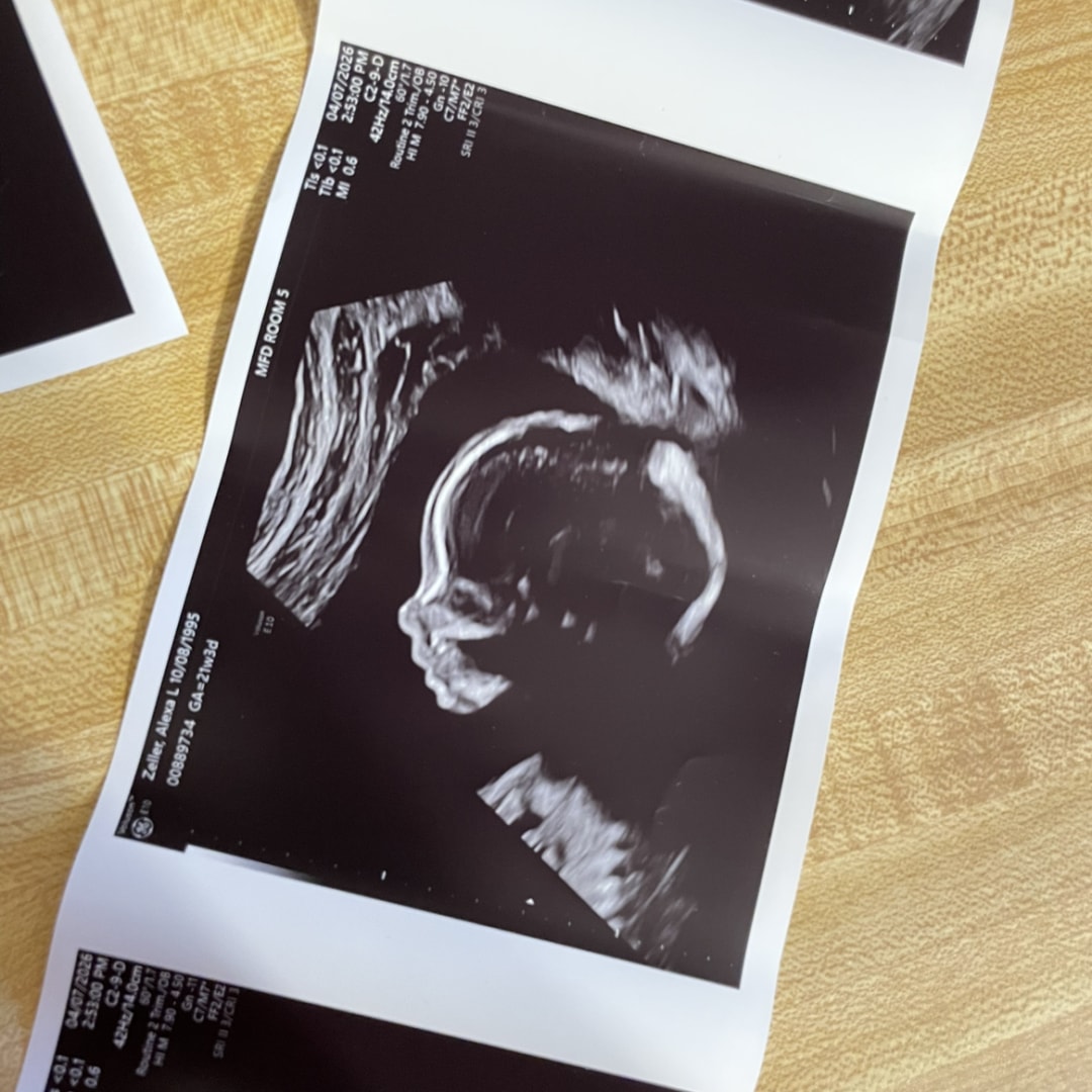 Photo shared by Alexa for their Babylist baby registry.