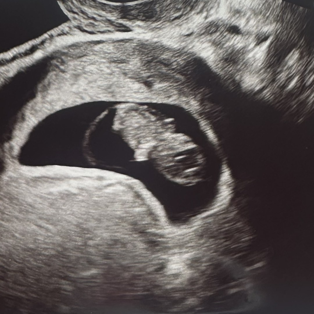 Photo shared by Ally for their Babylist baby registry.