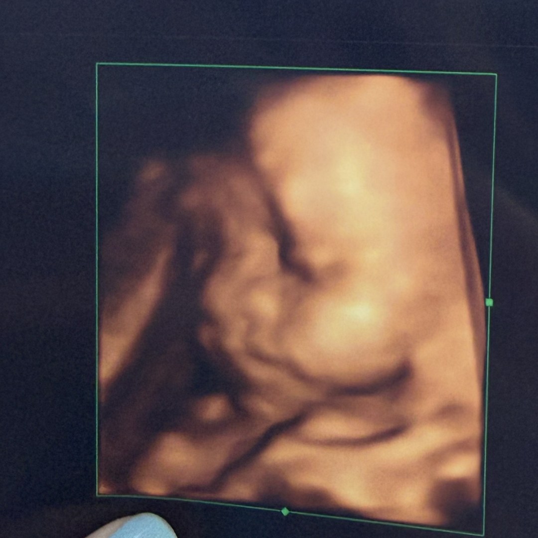 Photo shared by Emma for their Babylist baby registry.