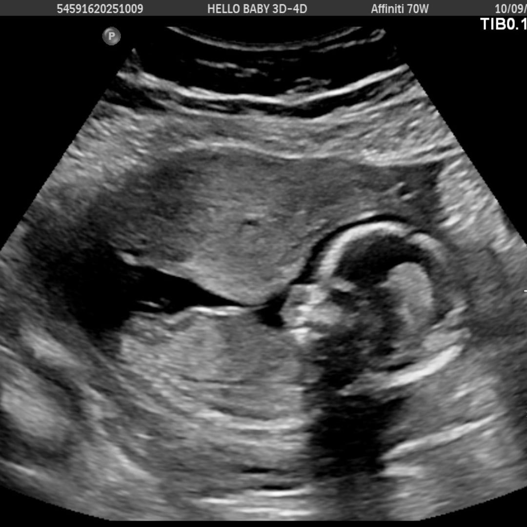 Photo shared by Myiah for their Babylist baby registry.