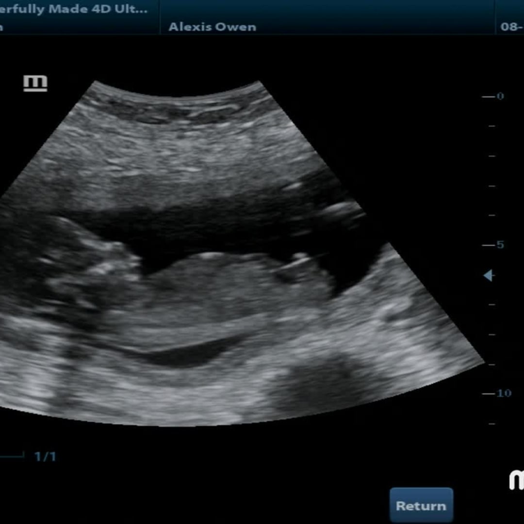 Photo shared by Alexis for their Babylist baby registry.