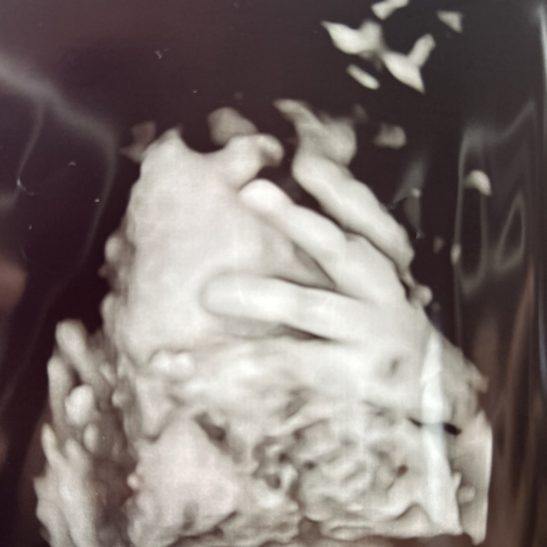 Photo shared by Amirah for their Babylist baby registry.