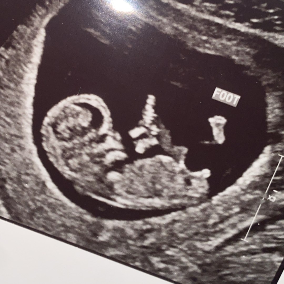 Photo shared by Calista for their Babylist baby registry.