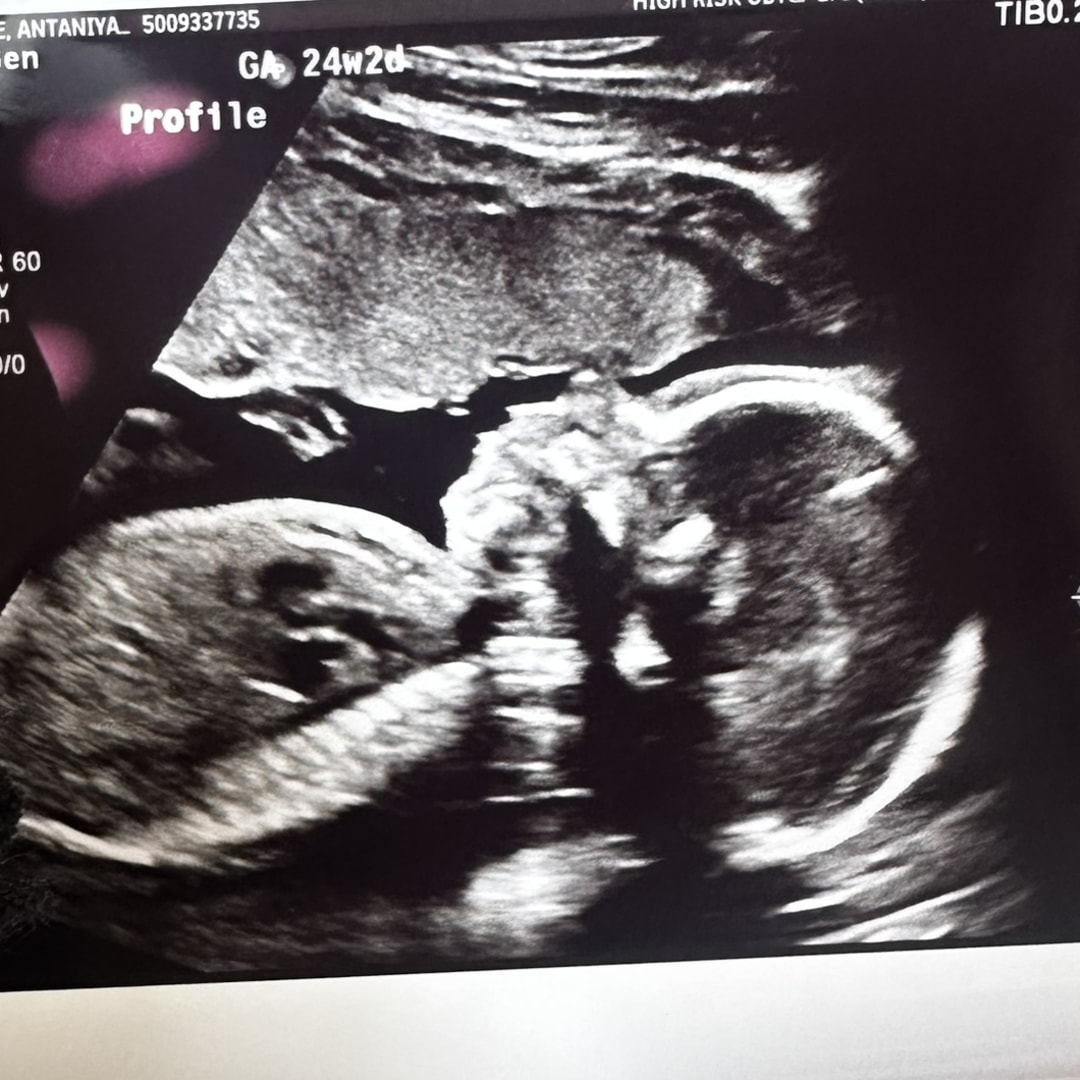 Photo shared by Antaniya for their Babylist baby registry.