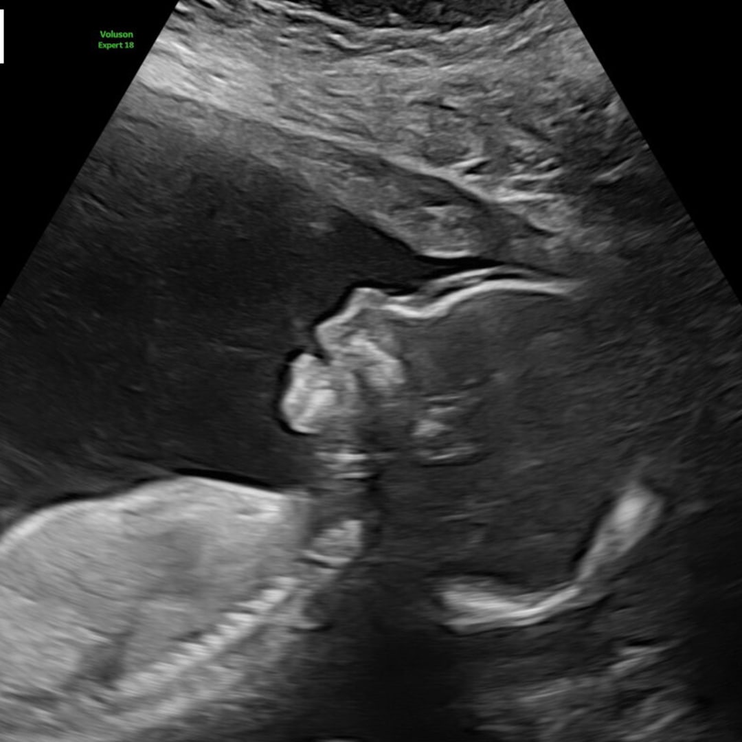 Photo shared by Alexia for their Babylist baby registry.
