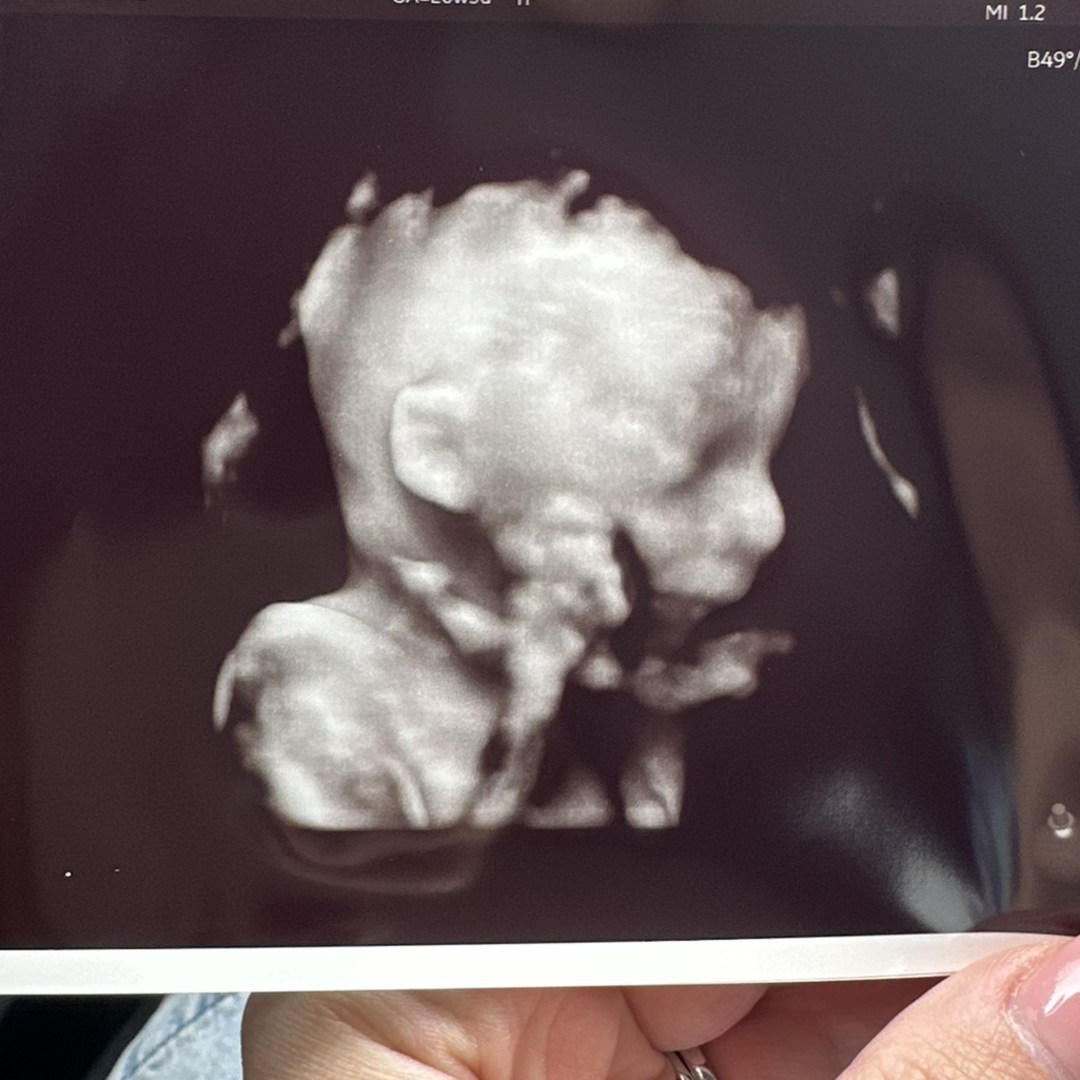 Photo shared by Kiara for their Babylist baby registry.