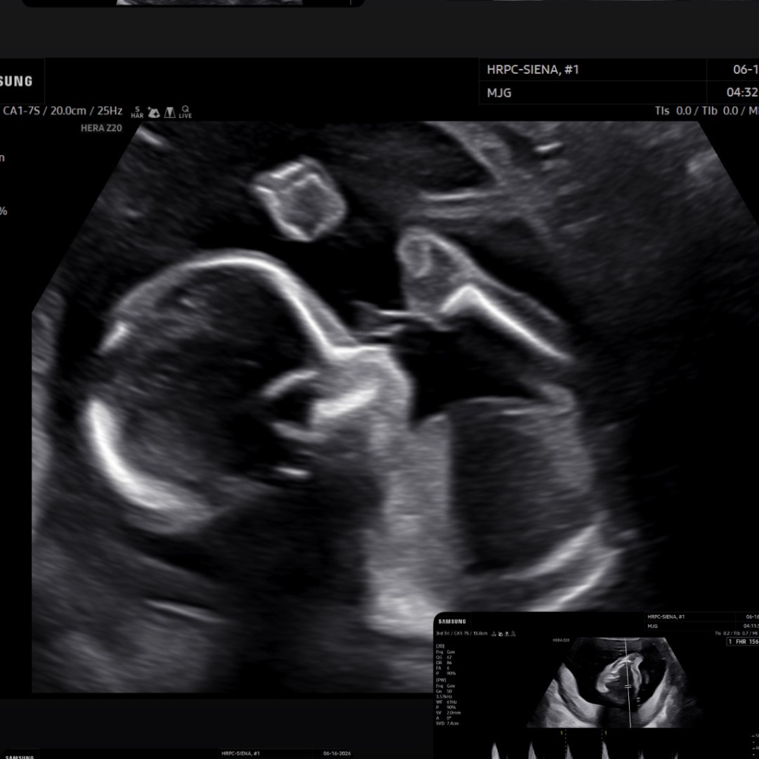 Photo shared by Stephanie for their Babylist baby registry.