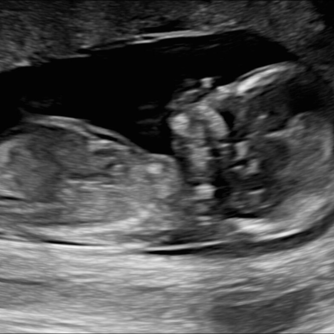 Photo shared by Lisa for their Babylist baby registry.