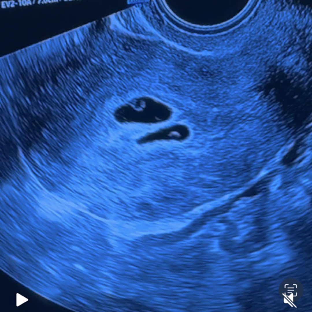 Photo shared by Glenys for their Babylist baby registry.