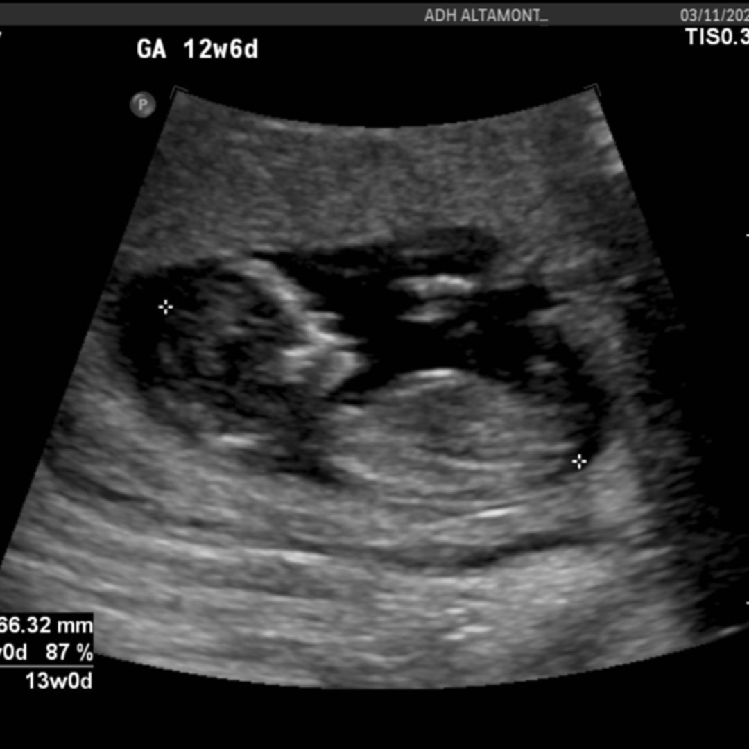 Photo shared by Brenda for their Babylist baby registry.