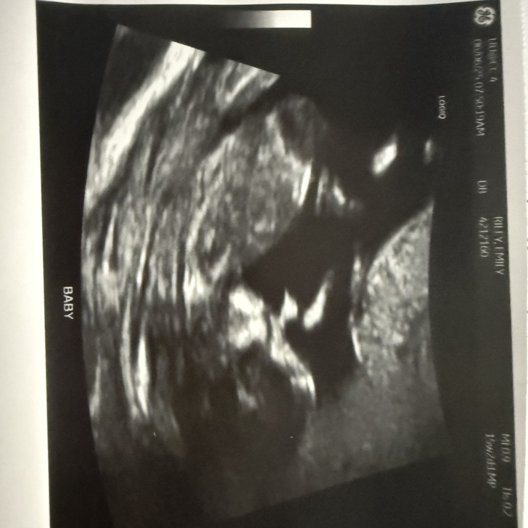Photo shared by Emily for their Babylist baby registry.