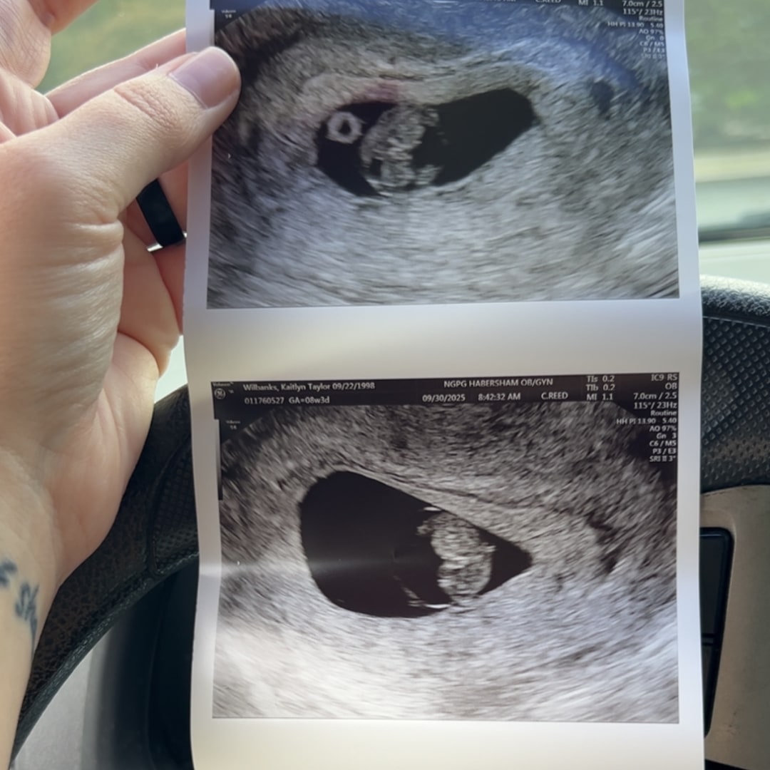 Photo shared by Katie for their Babylist baby registry.