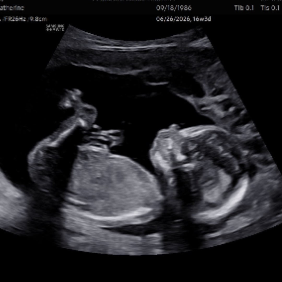 Photo shared by Catherine for their Babylist baby registry.