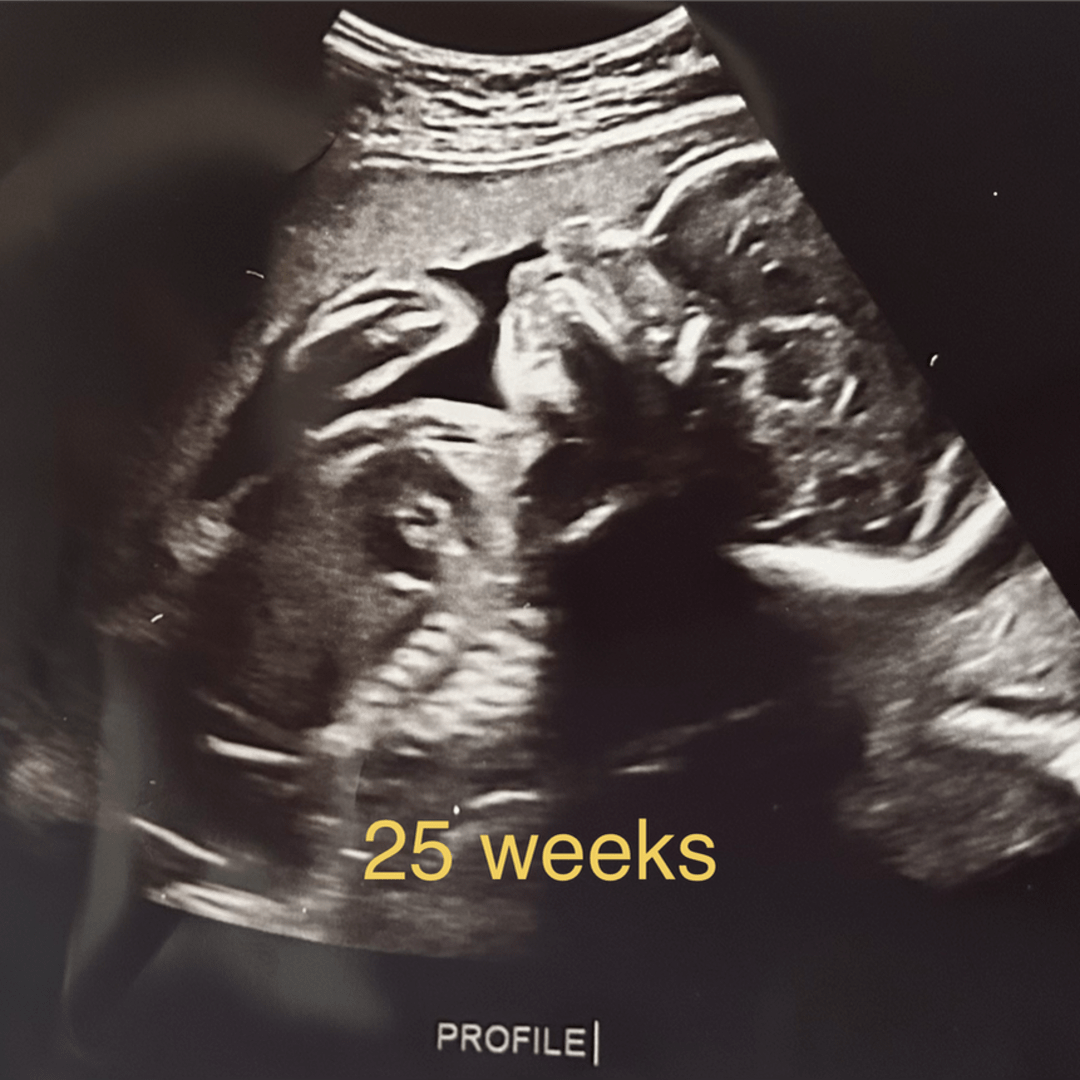 Photo shared by Tristian for their Babylist baby registry.
