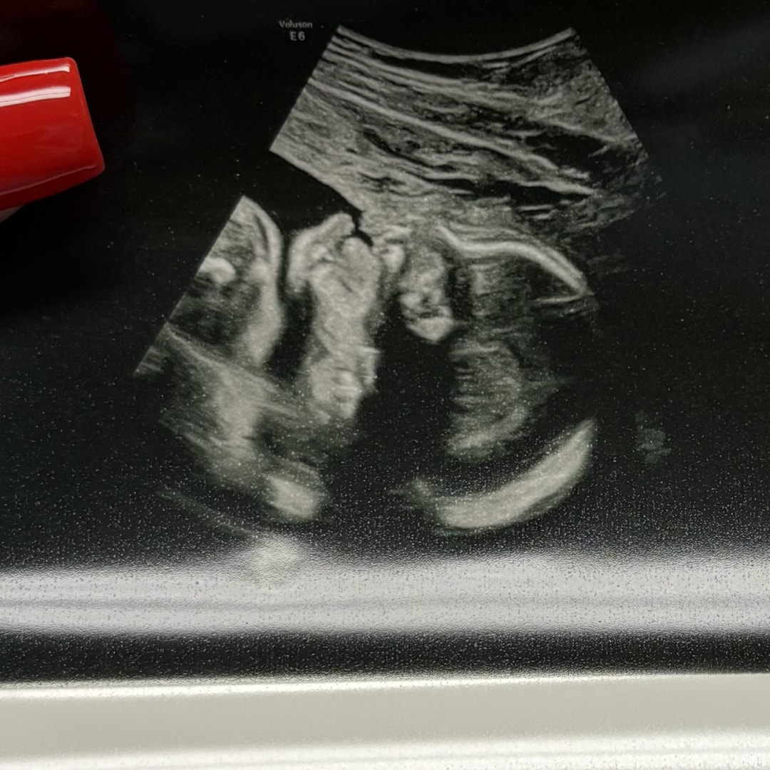 Photo shared by Hailey for their Babylist baby registry.