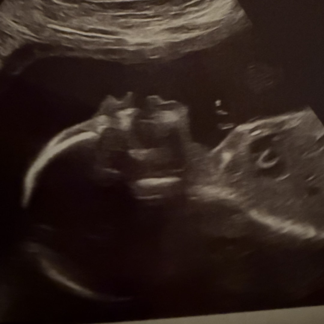 Photo shared by Gabriell for their Babylist baby registry.