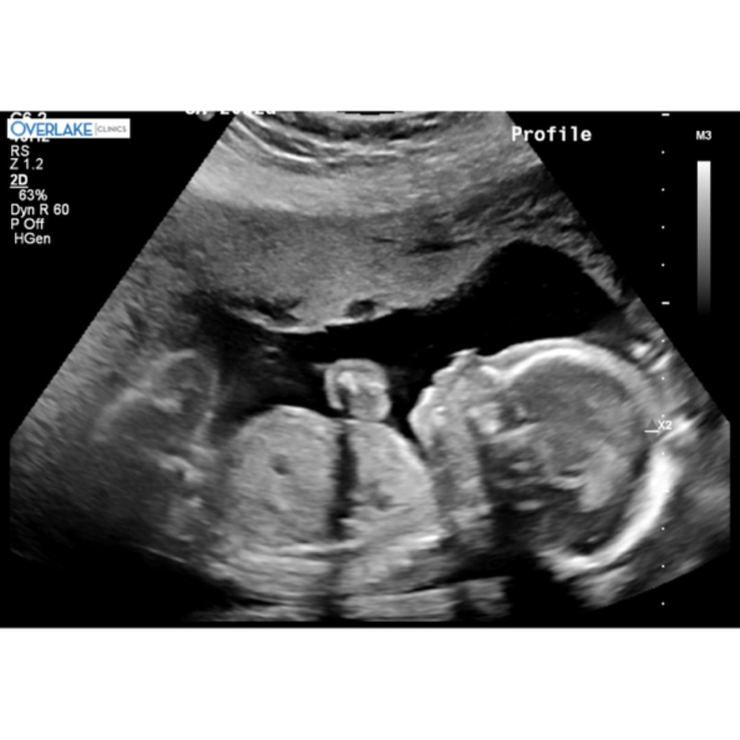 Photo shared by Laura for their Babylist baby registry.