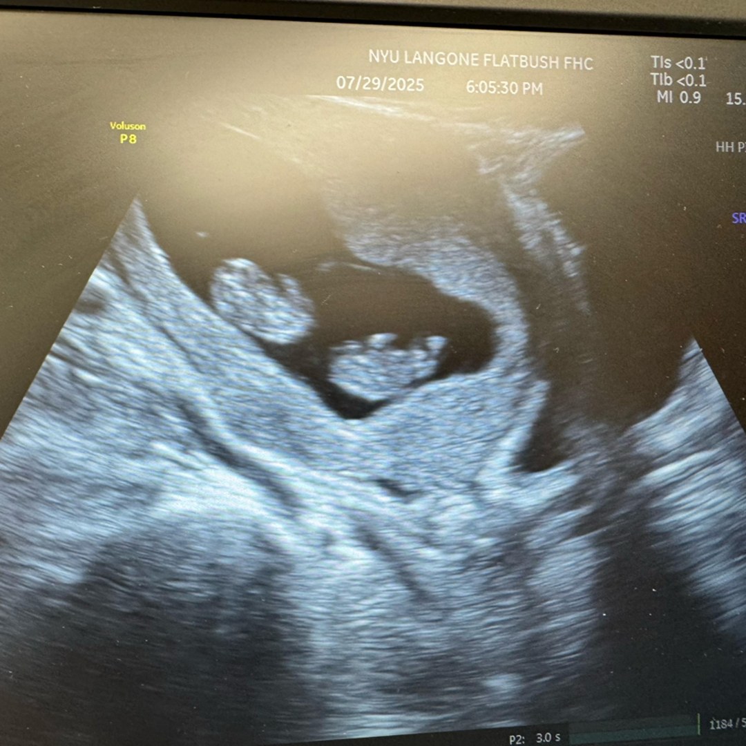 Photo shared by Clemence for their Babylist baby registry.