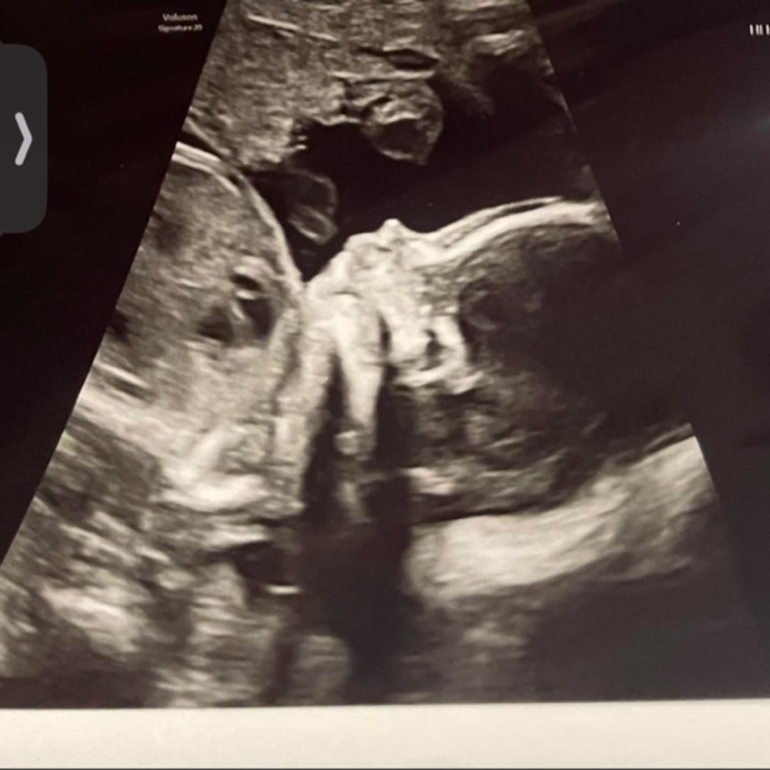 Photo shared by Dibeni for their Babylist baby registry.