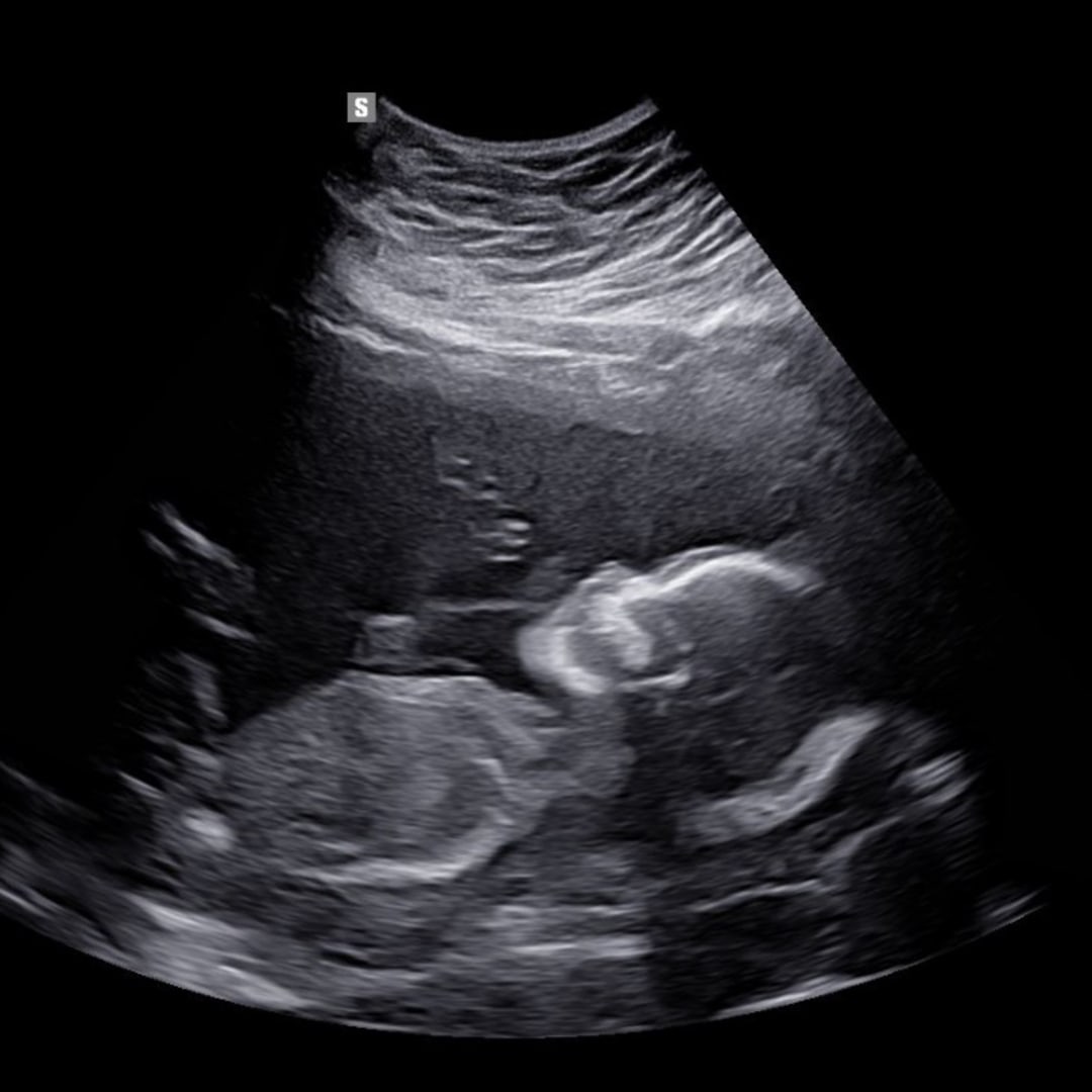 Photo shared by Amanda for their Babylist baby registry.