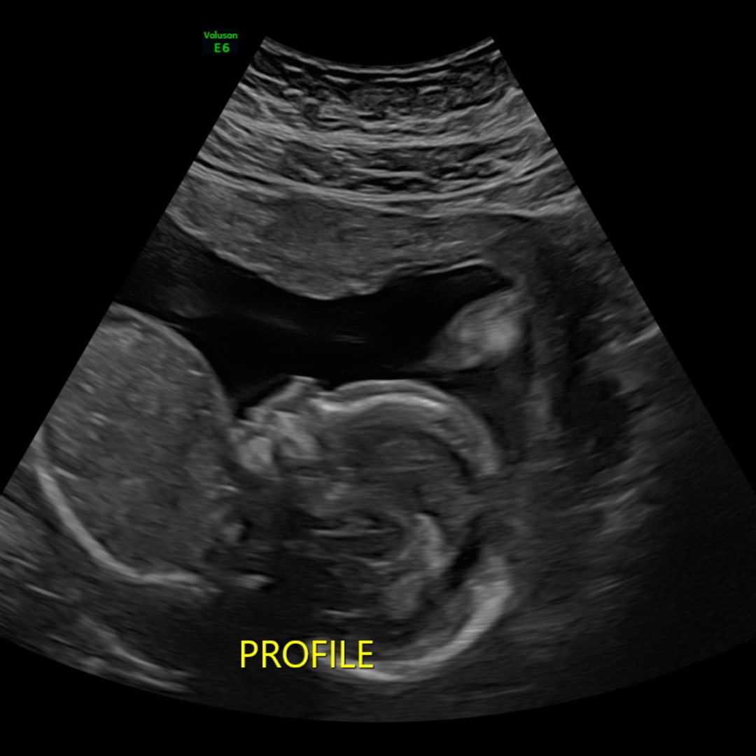 Photo shared by Emily for their Babylist baby registry.