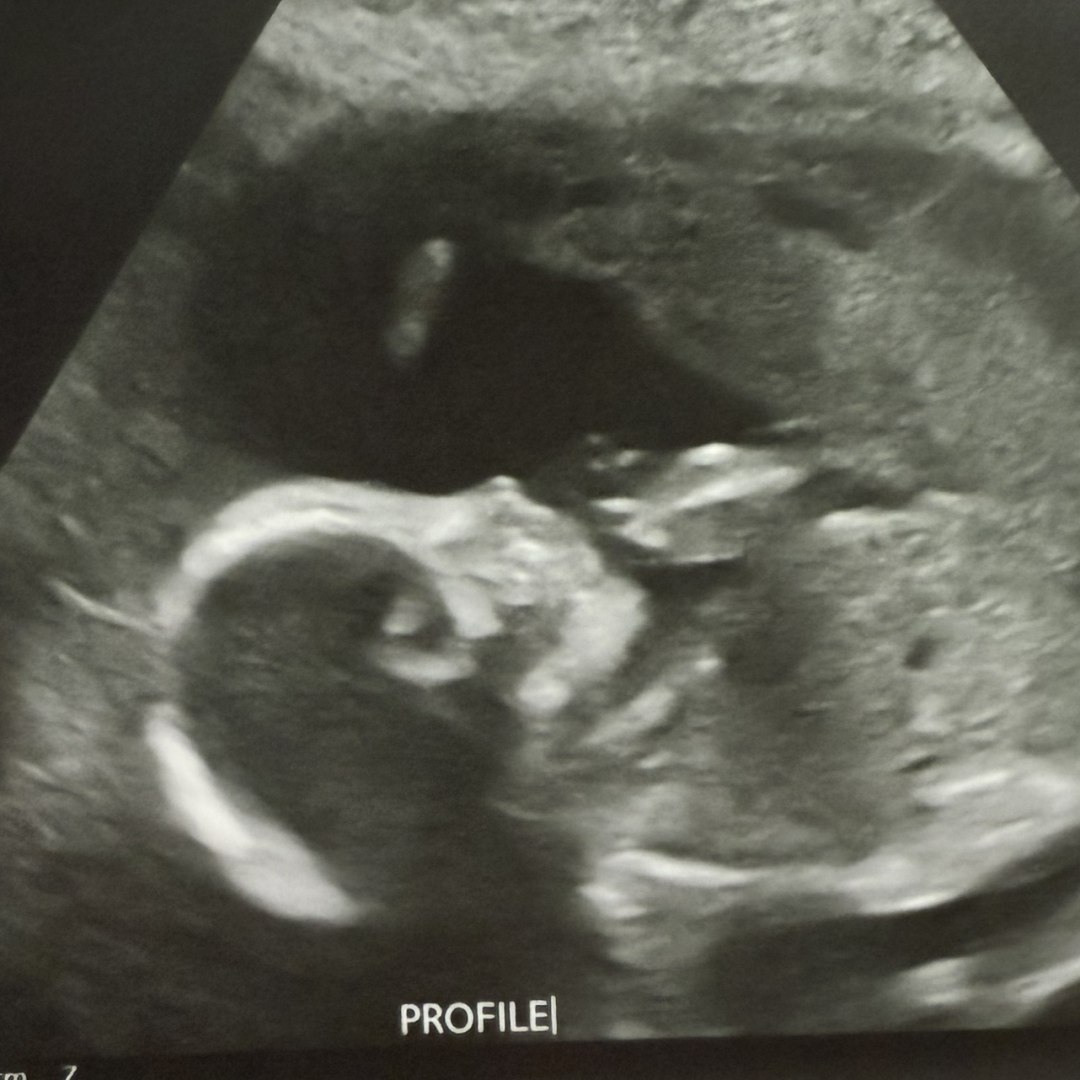 Photo shared by Heather for their Babylist baby registry.