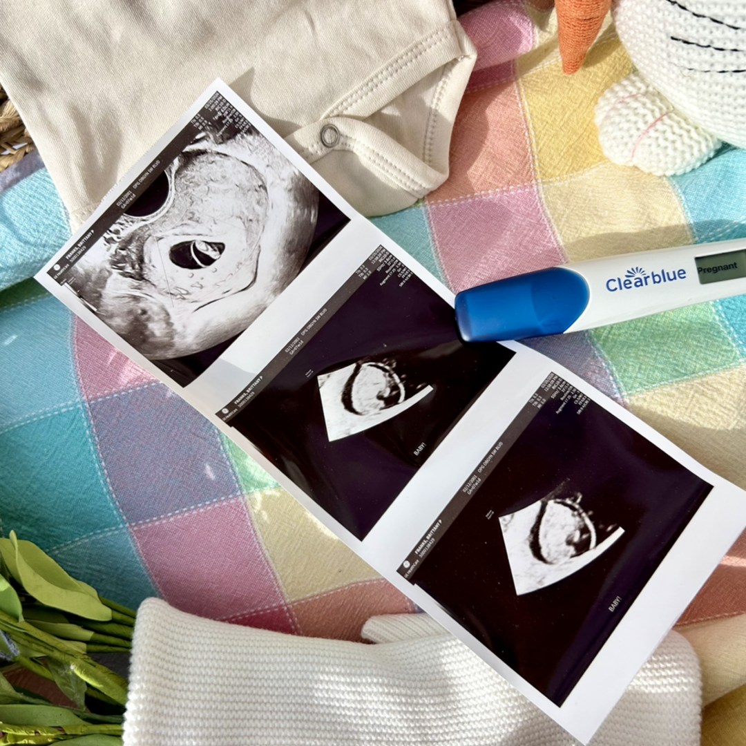 Photo shared by Brittany for their Babylist baby registry.