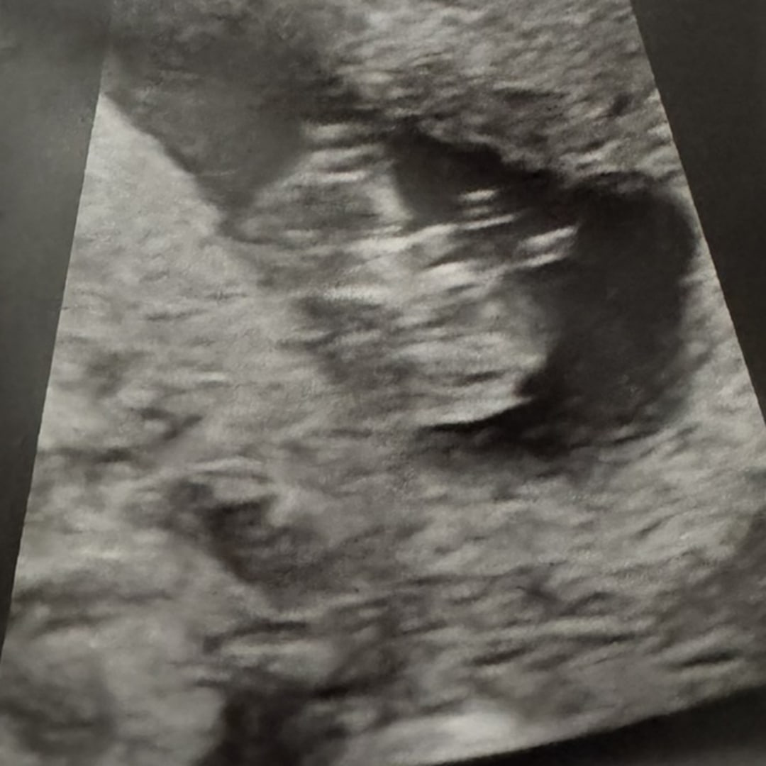 Photo shared by Maddison for their Babylist baby registry.