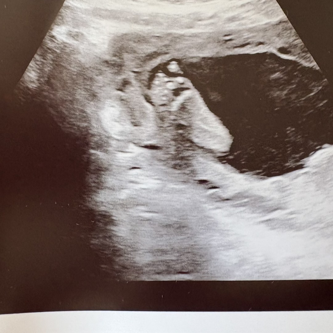 Photo shared by Madison for their Babylist baby registry.