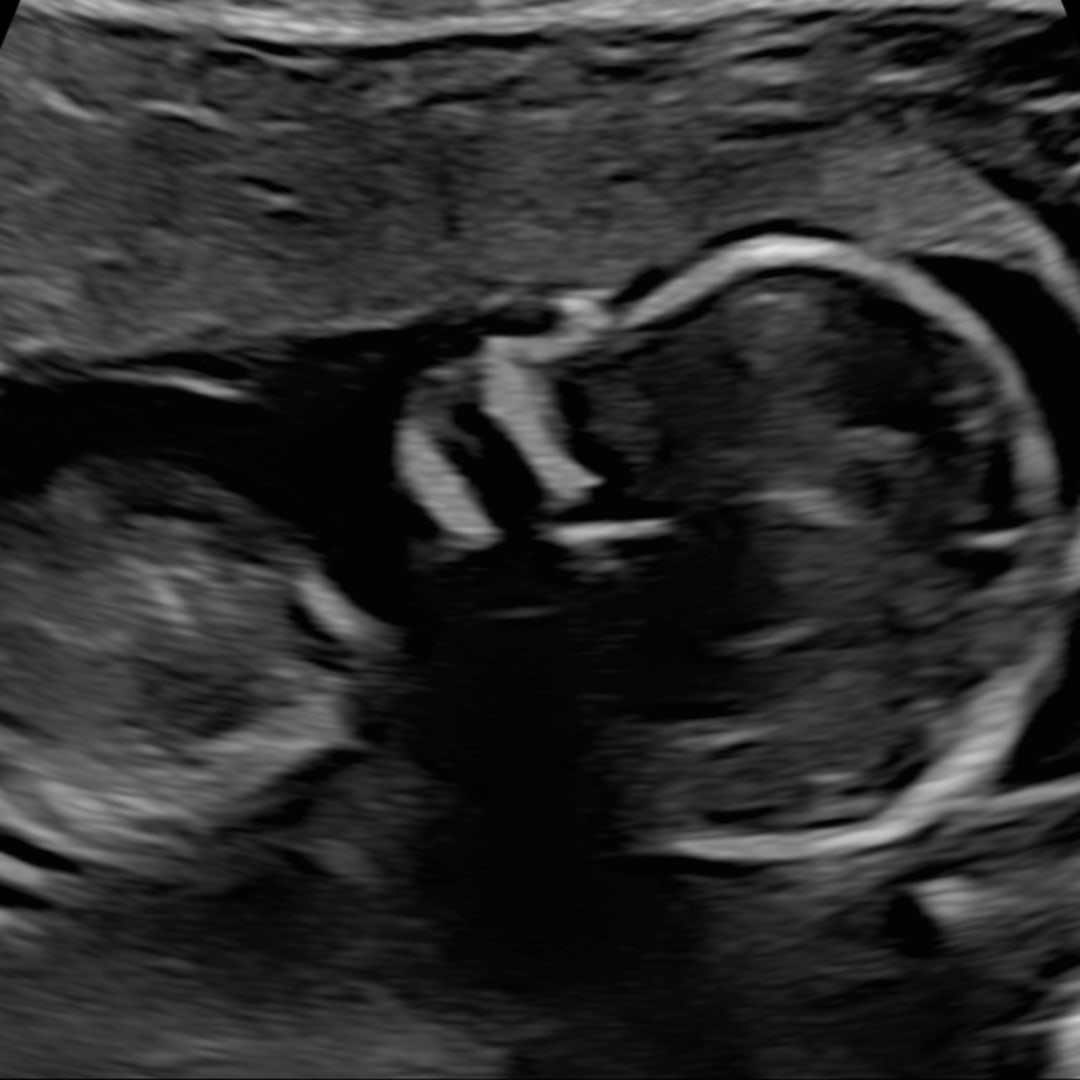 Photo shared by Hannah for their Babylist baby registry.