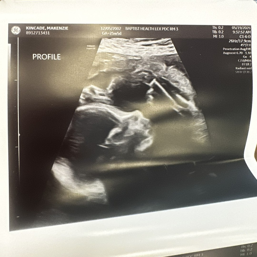 Photo shared by Makenzie for their Babylist baby registry.