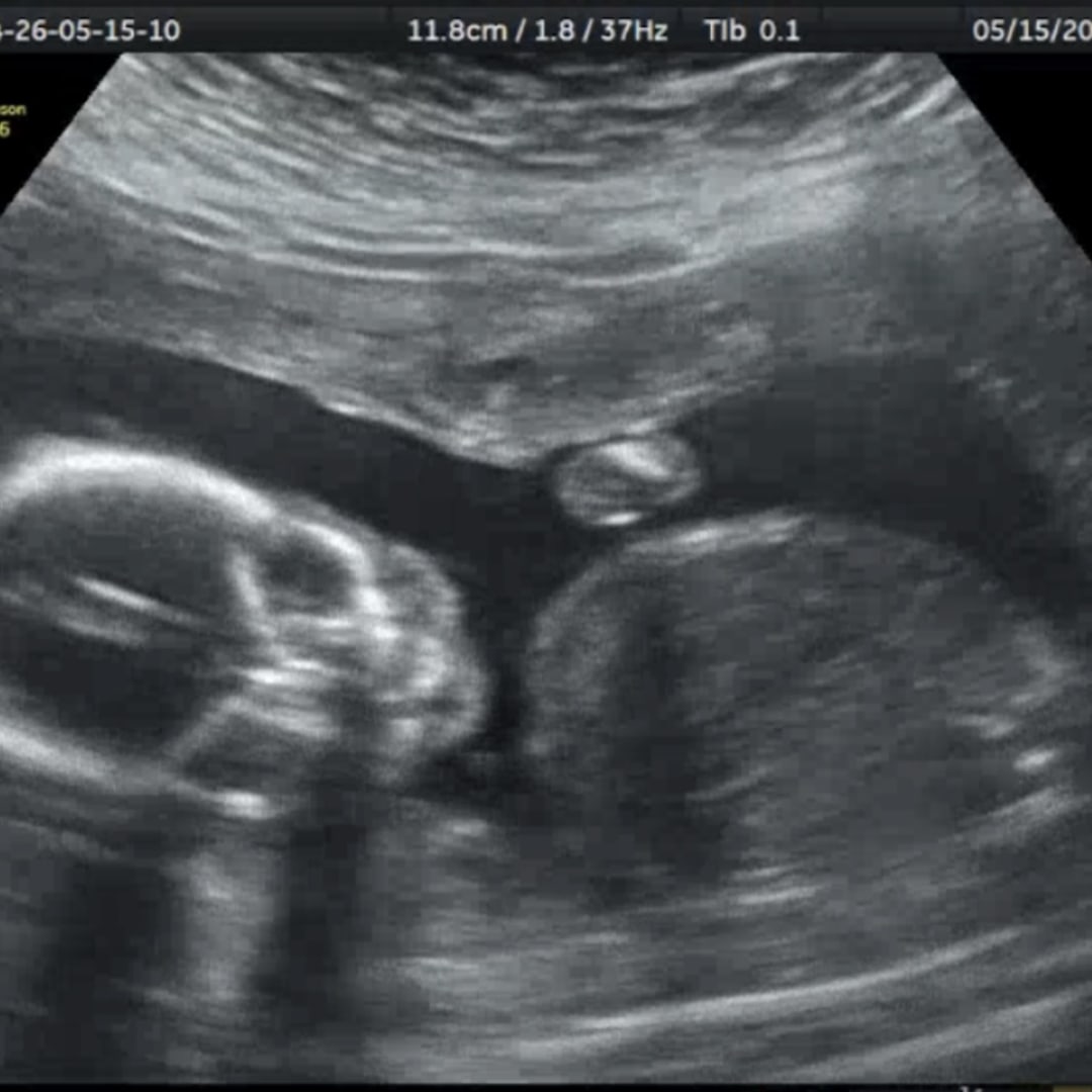 Photo shared by Autumn for their Babylist baby registry.